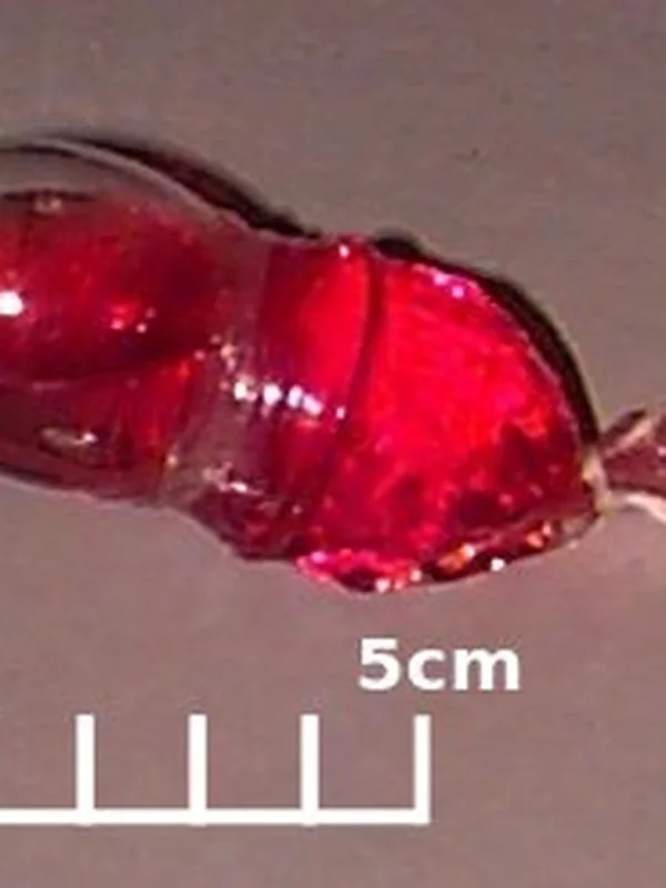 Medical Dialysis Machine