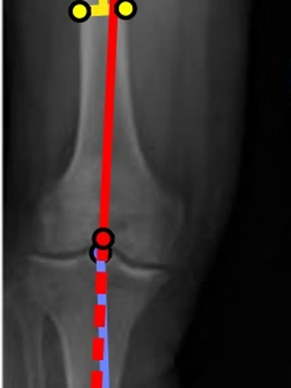 Computer-Aided Surgery Systems