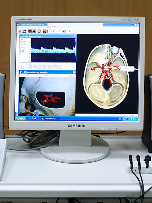 Medical Ultrasound Doppler Imaging